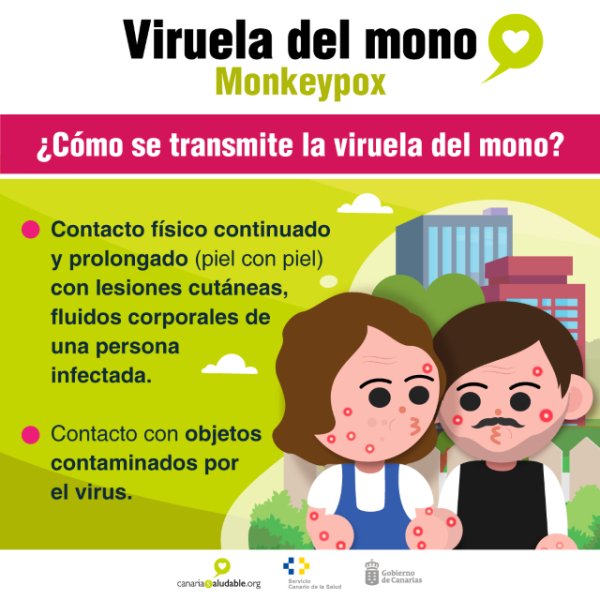 Sanidad expone ante la Oficina Europea de la OMS la gestión del brote de viruela del mono