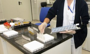 Sanidad comunica que no hay nuevos casos de viruela del mono desde el martes