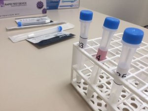 Sanidad registra 5.827 casos de COVID-19 en los últimos tres días