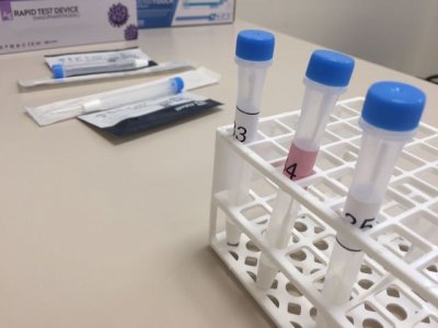 Sanidad registra 5.827 casos de COVID-19 en los últimos tres días