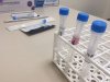 Sanidad registra 5.827 casos de COVID-19 en los últimos tres días