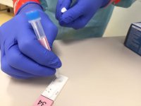 (18-02-22) Sanidad contabiliza 1.158 casos de COVID-19 en las &uacute;ltimas 24 horas