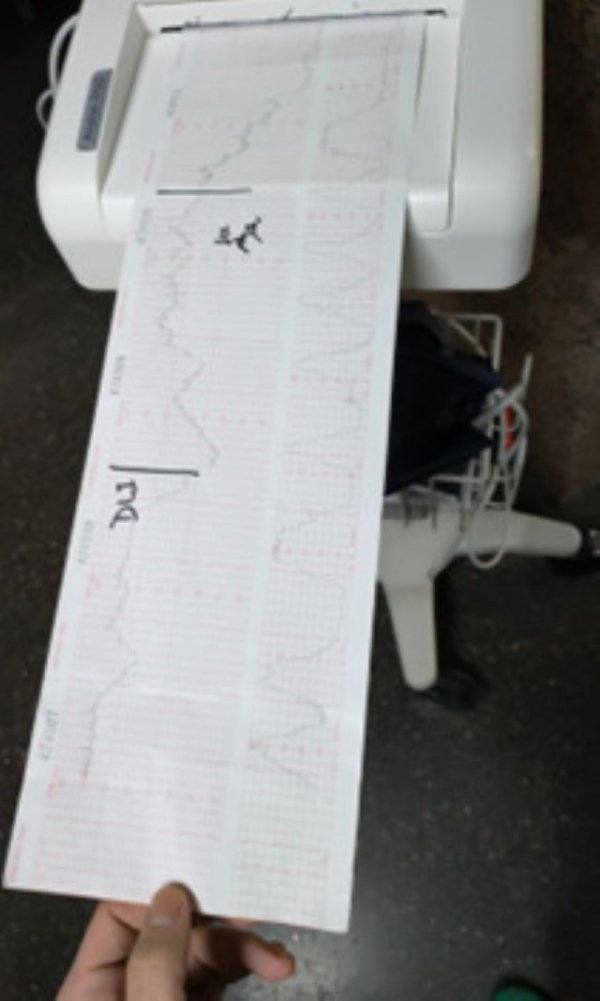 El HUC colabora en la organización de un curso de registros cardiotocográficos