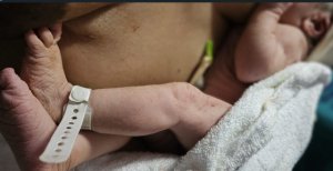 Sanidad ampl&iacute;a el cribado neonatal a 31 enfermedades raras