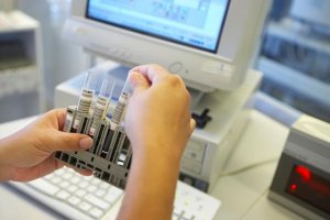 Sanidad comunica un caso confirmado y cinco en estudio de viruela del mono desde el viernes