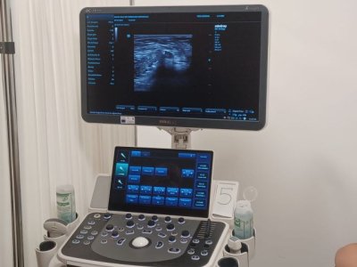 Sanidad saca a licitaci&oacute;n la adjudicaci&oacute;n de 37 ec&oacute;grafos por m&aacute;s de tres millones de euros para hospitales del SCS