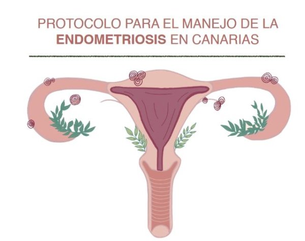 Sanidad pone en marcha un protocolo asistencial para atención a mujeres con endometriosis